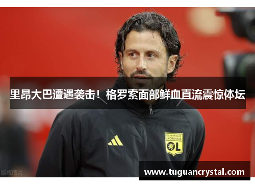 里昂大巴遭遇袭击！格罗索面部鲜血直流震惊体坛